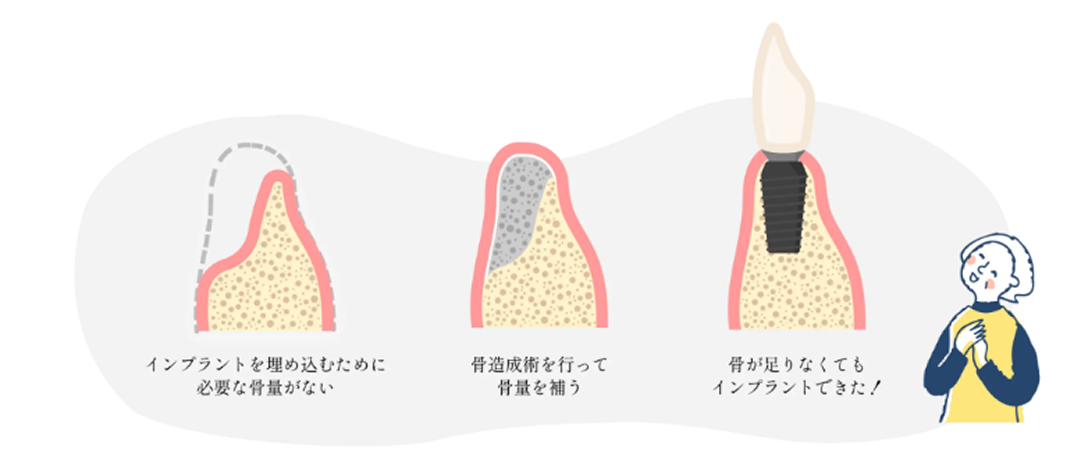他院でインプラント治療を断られた方へ