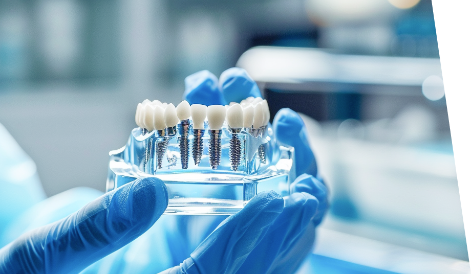 手術当日に仮歯を装着するイメージ